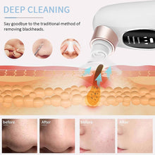 Electric Blackhead Remover